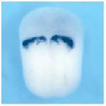Expression Image