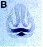 Expression Image